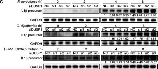 Detection of IL-1 beta/IL-1F2 by Western Blot