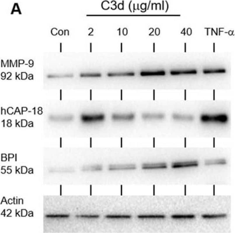 Detection of MMP-9 by Western Blot