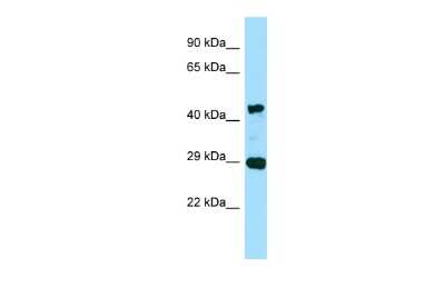 Western Blot: actin, gamma 2 Antibody [NBP2-83925]