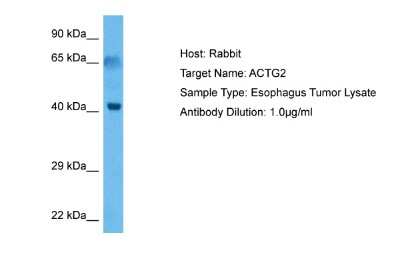 Western Blot: actin, gamma 2 Antibody [NBP2-83926]