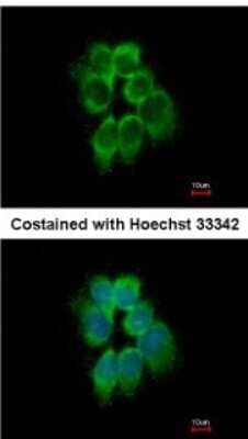 Immunocytochemistry/ Immunofluorescence: actin-related protein 2/3 complex subunit 1B Antibody [NBP2-15262]