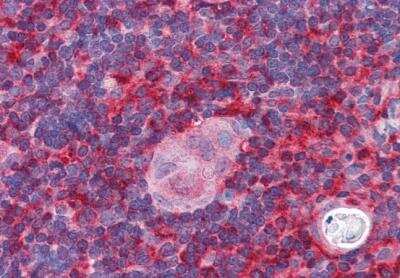 Immunohistochemistry-Paraffin: actin-related protein 2/3 complex subunit 1B Antibody [NB300-898]