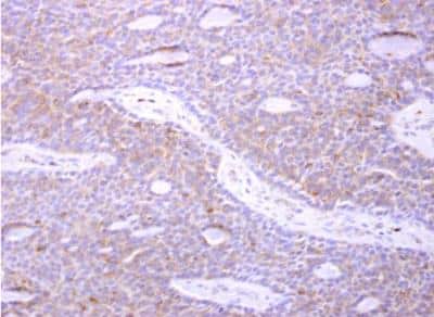 Immunohistochemistry-Paraffin: actin-related protein 2/3 complex subunit 1B Antibody [NBP2-15263]