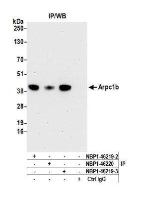 Immunoprecipitation: actin-related protein 2/3 complex subunit 1B Antibody [NBP1-46219]