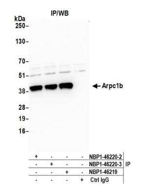 Immunoprecipitation: actin-related protein 2/3 complex subunit 1B Antibody [NBP1-46220]