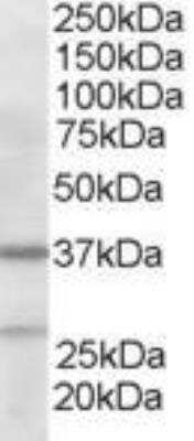 Western Blot: actin-related protein 2/3 complex subunit 1B Antibody [NB300-898]