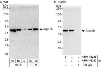 Western Blot: actin-related protein 2/3 complex subunit 1B Antibody [NBP1-46219]