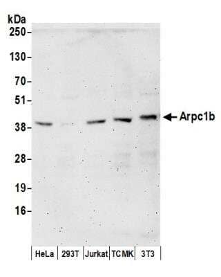 Western Blot: actin-related protein 2/3 complex subunit 1B Antibody [NBP1-46219]