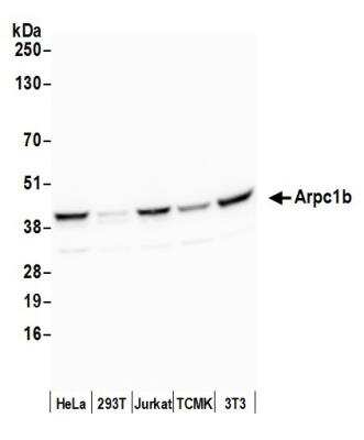 Western Blot: actin-related protein 2/3 complex subunit 1B Antibody [NBP1-46220]