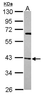 Western Blot: actin-related protein 2/3 complex subunit 1B Antibody [NBP2-15262]