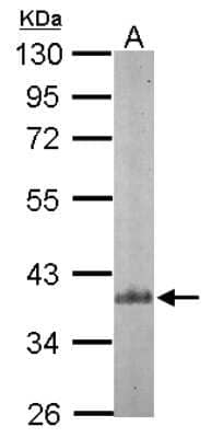 Western Blot: actin-related protein 2/3 complex subunit 1B Antibody [NBP2-15263]