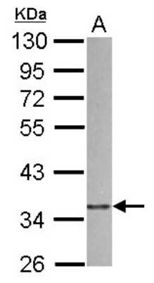 Western Blot: actin-related protein 2/3 complex subunit 1B Antibody [NBP2-15264]