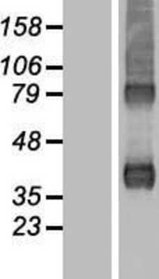 Western Blot: actin-related protein 2/3 complex subunit 1B Overexpression Lysate [NBL1-07726]