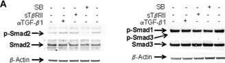 Detection of Rat TGF-beta 1/1.2 by Western Blot