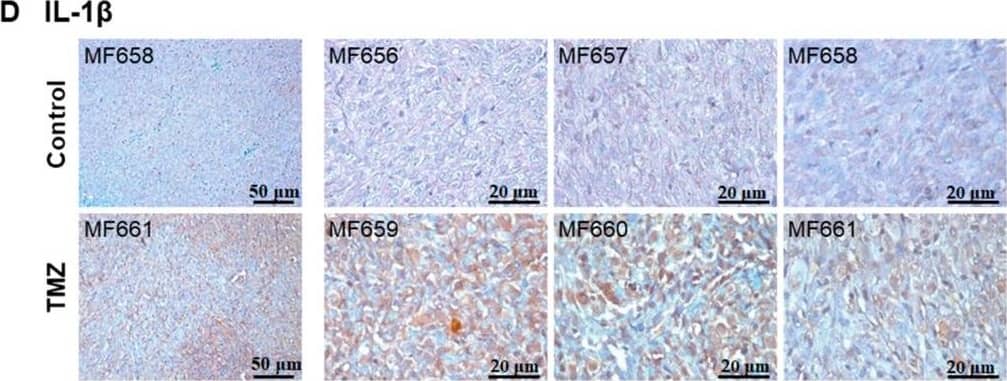 Detection of Human IL-1 beta/IL-1F2 by Immunohistochemistry