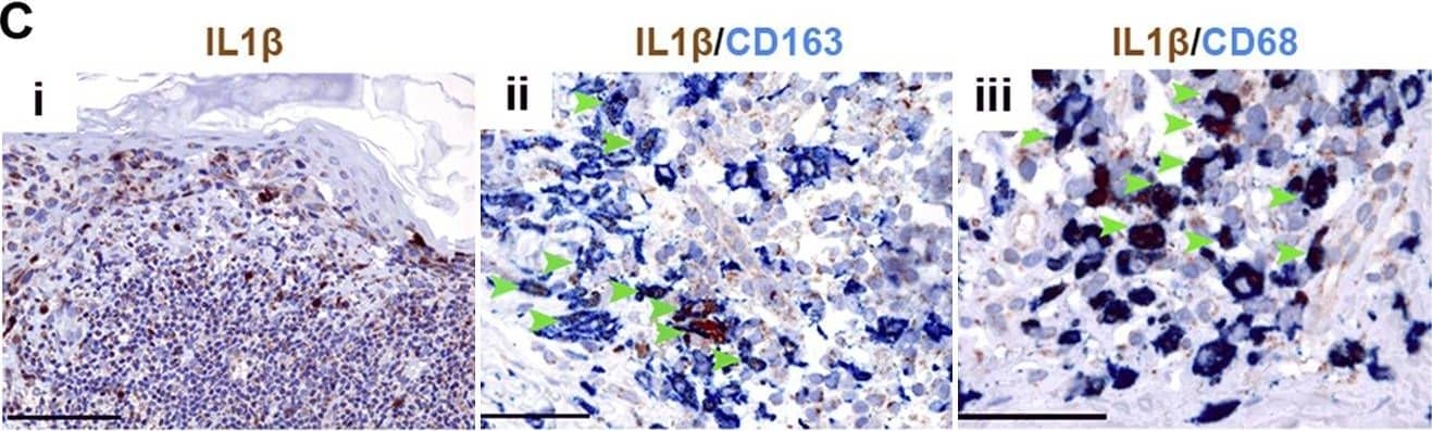 Detection of Human IL-1 beta/IL-1F2 by Immunohistochemistry