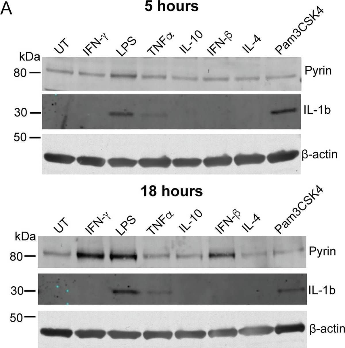Detection of IL-1 beta/IL-1F2 by Western Blot