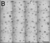Detection of Human IL-6 by Block/Neutralize