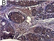 Detection of Human IL-6 by Immunohistochemistry