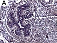 Detection of Human IL-6 by Immunohistochemistry