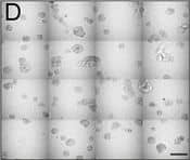Detection of Human IL-6 by Block/Neutralize