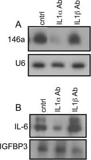 Detection of Human IL-6 by Western Blot