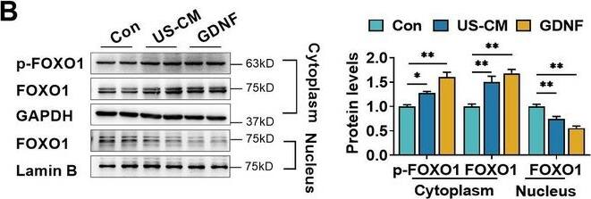 Detection of GDNF by Western Blot