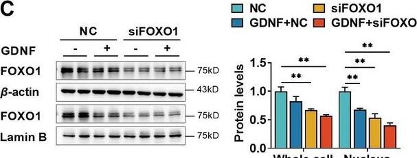 Detection of GDNF by Western Blot