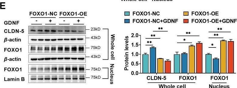 Detection of GDNF by Western Blot