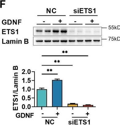 Detection of GDNF by Western Blot