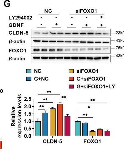 Detection of GDNF by Western Blot