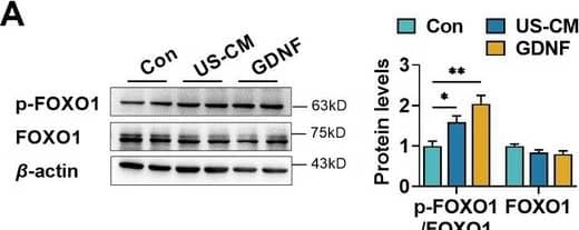 Detection of GDNF by Western Blot