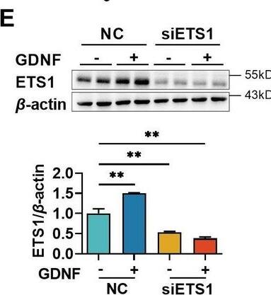 Detection of GDNF by Western Blot