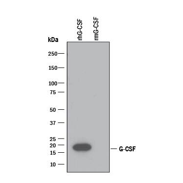 Detection of Recombinant Human G-CSF antibody by Western Blot.