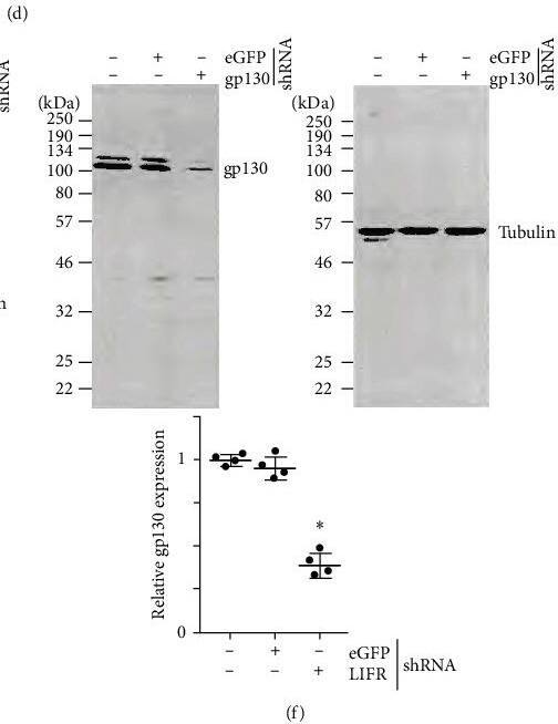 Detection of gp130 by Western Blot