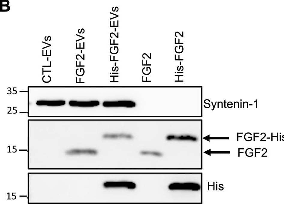 Detection of FGF basic/FGF2/bFGF by Western Blot