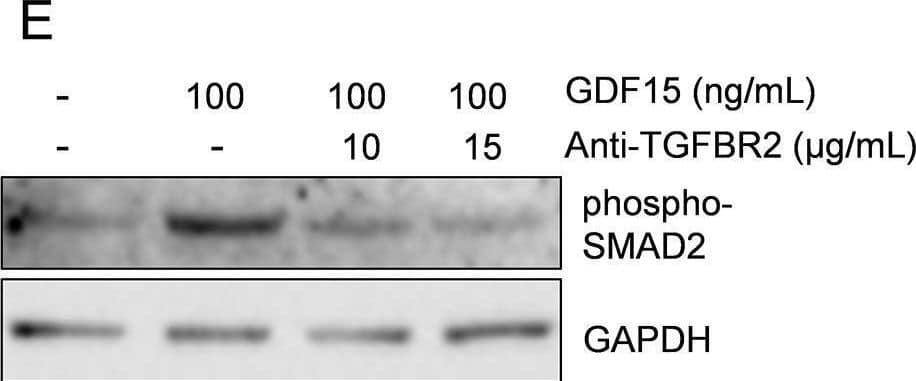Detection of TGF-beta RII by Western Blot
