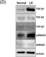 Detection of Human TGF-beta 3 by Western Blot