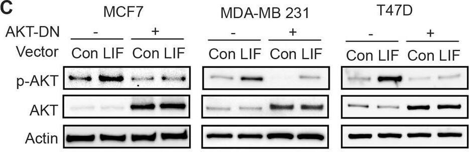 Detection of Human LIF by Western Blot