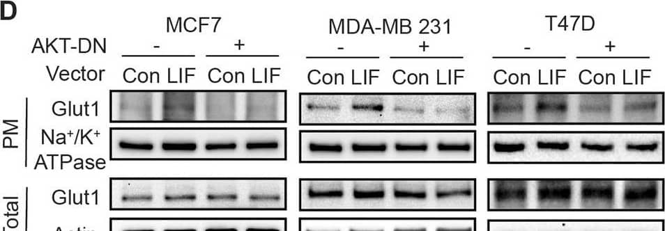 Detection of Human LIF by Western Blot