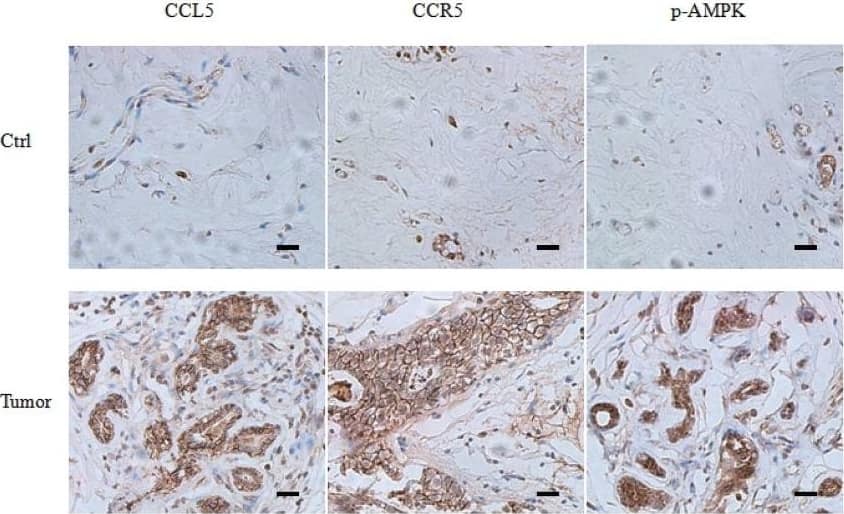 Detection of Human CCL5/RANTES by Immunohistochemistry