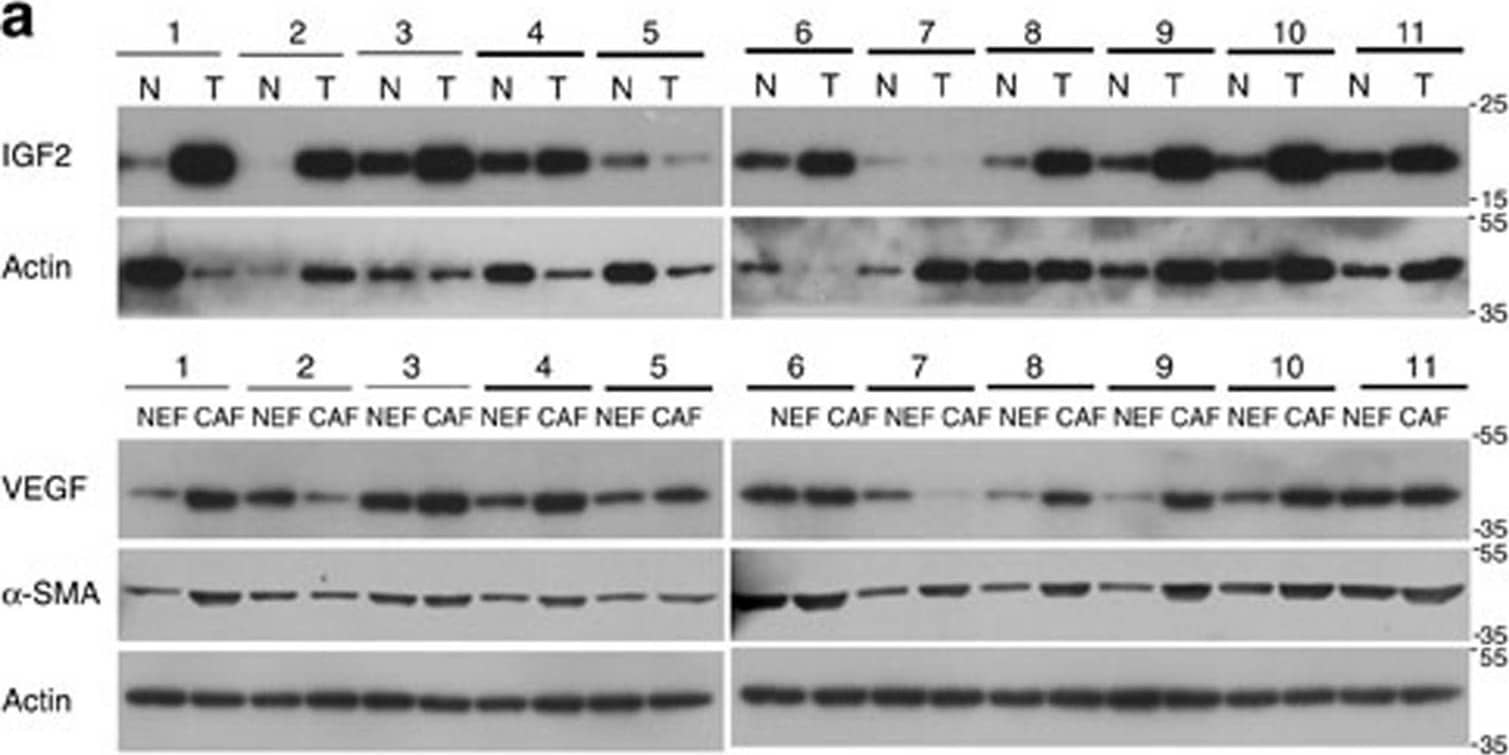 Detection of Human IGF-II/IGF2 by Western Blot
