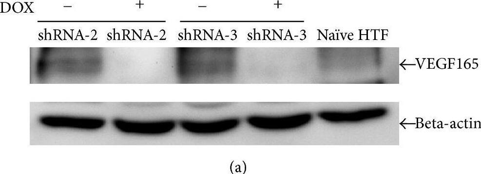 Detection of Human VEGF by Western Blot