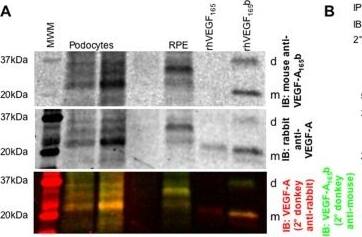 Detection of Human VEGF by Western Blot