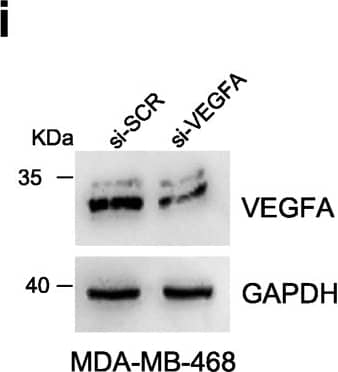 Detection of Human VEGF by Western Blot