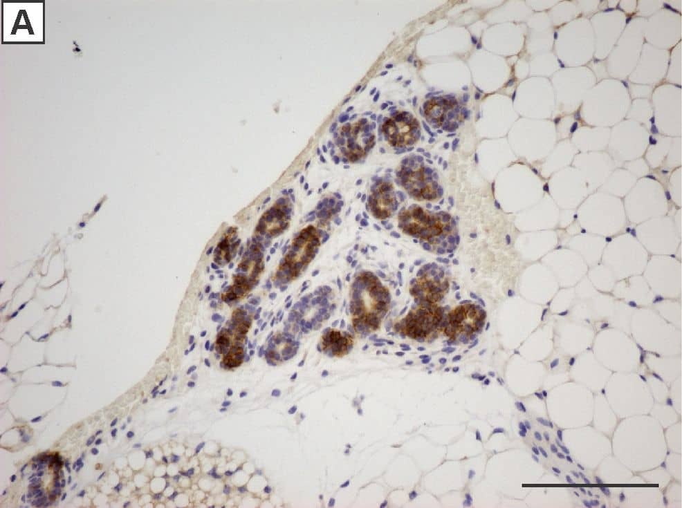Detection of Mouse IGF-I R/IGF1R by Immunohistochemistry