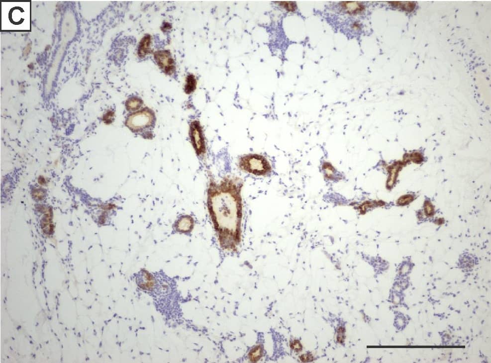 Detection of Mouse IGF-I R/IGF1R by Immunohistochemistry