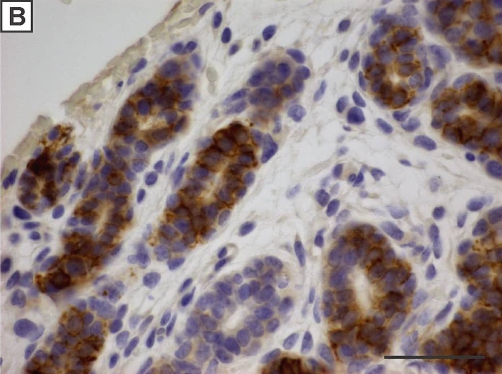 Detection of Mouse IGF-I R/IGF1R by Immunohistochemistry