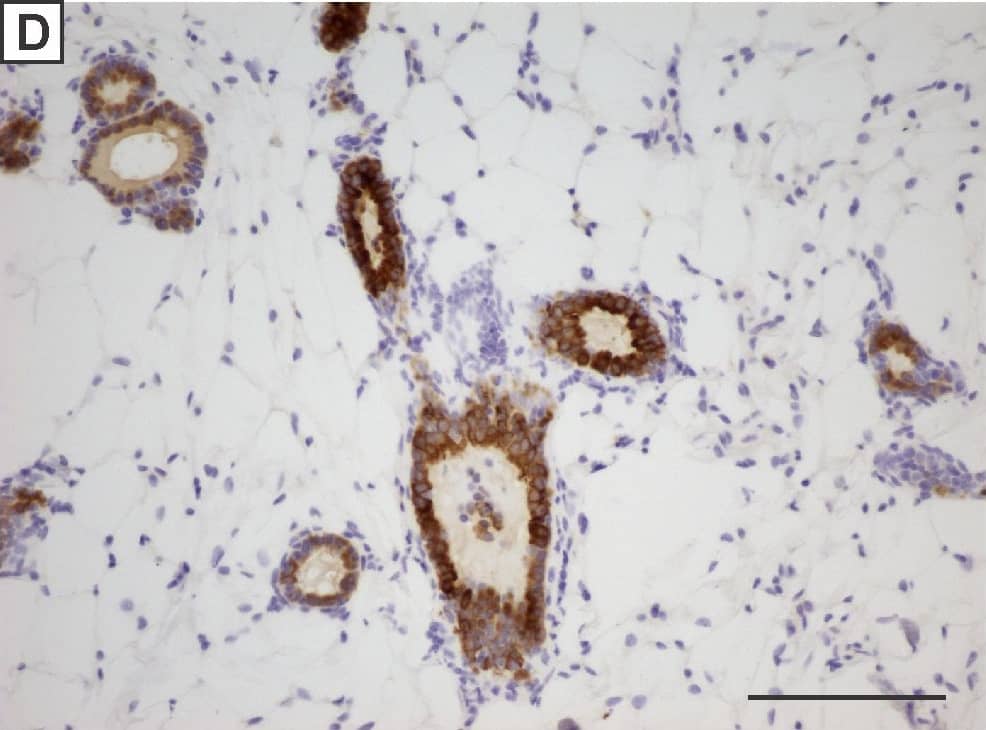 Detection of Mouse IGF-I R/IGF1R by Immunohistochemistry