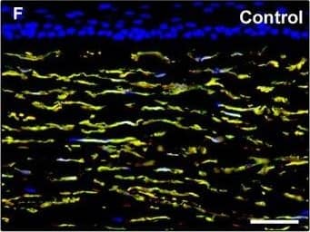 Detection of Human PDGFR alpha by Immunocytochemistry/Immunofluorescence